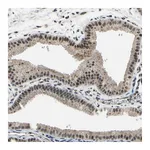 Atlas Antibodies Anti-ZNF174 Antibody