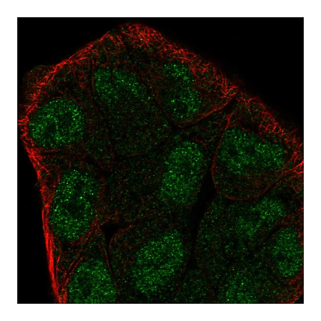 Atlas Antibodies Anti-ZMYM6 Antibody