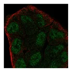 Atlas Antibodies Anti-ZMYM6 Antibody