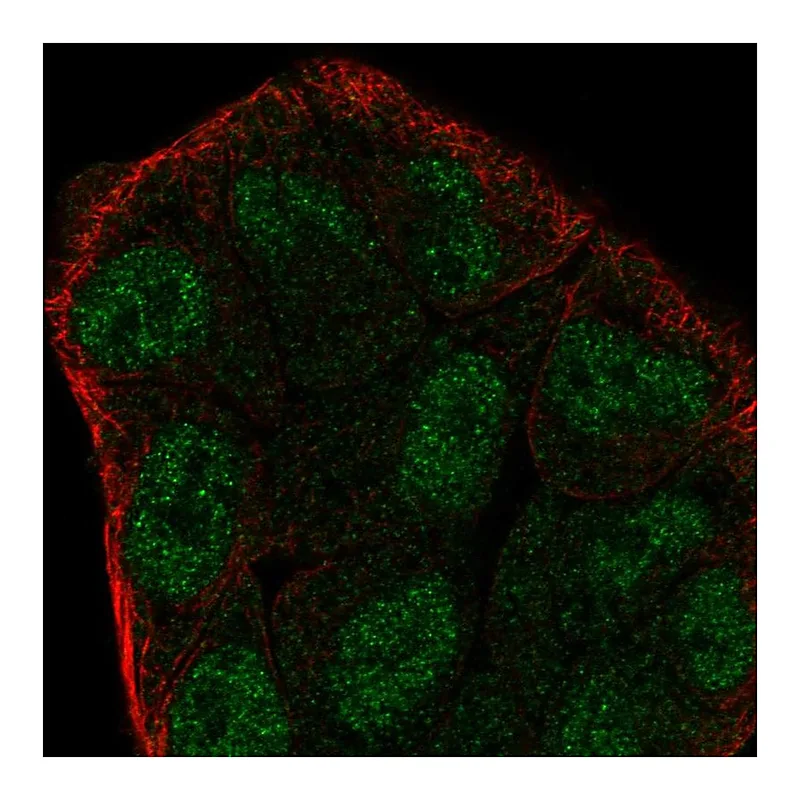 Atlas Antibodies Anti-ZMYM6 Antibody