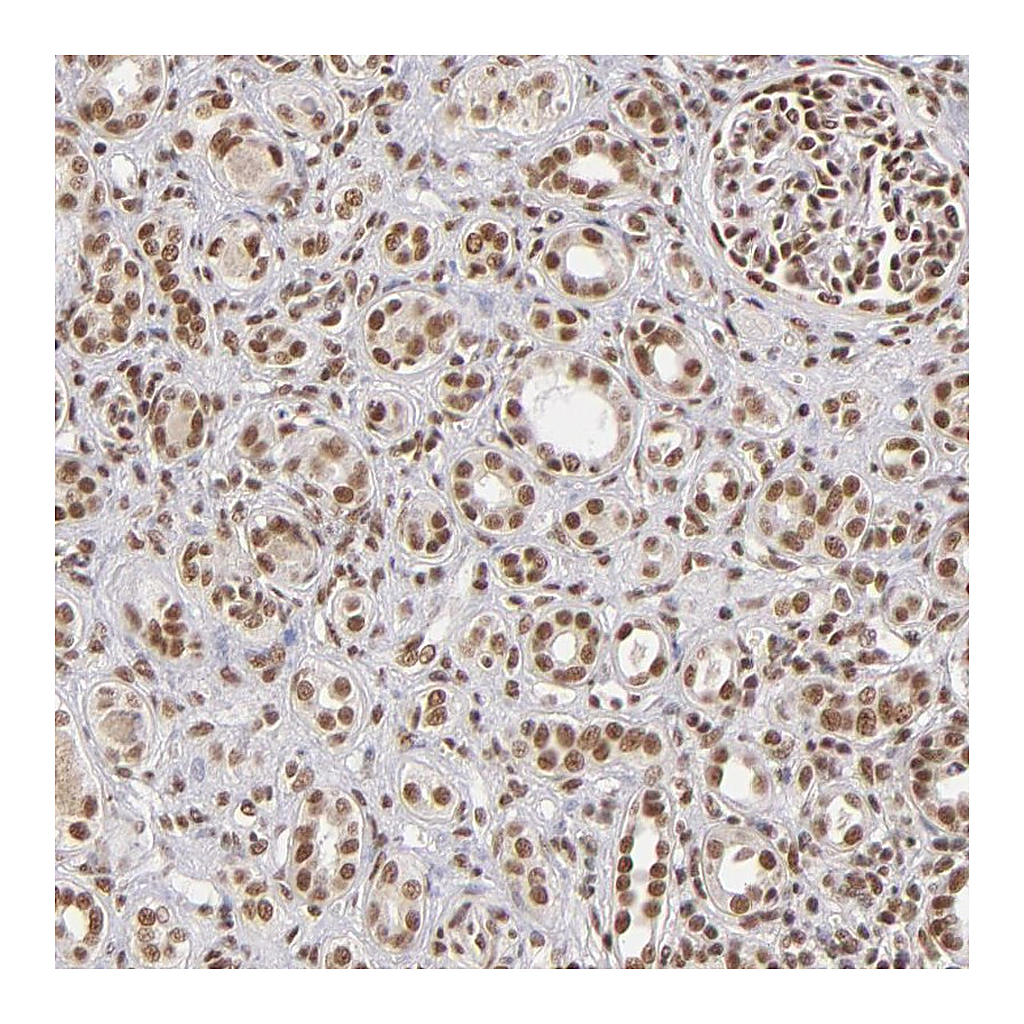 Atlas Antibodies Anti-ZNF148 Antibody
