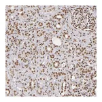 Atlas Antibodies Anti-ZNF148 Antibody