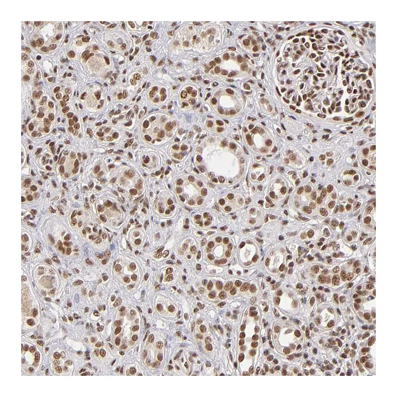 Atlas Antibodies Anti-ZNF148 Antibody