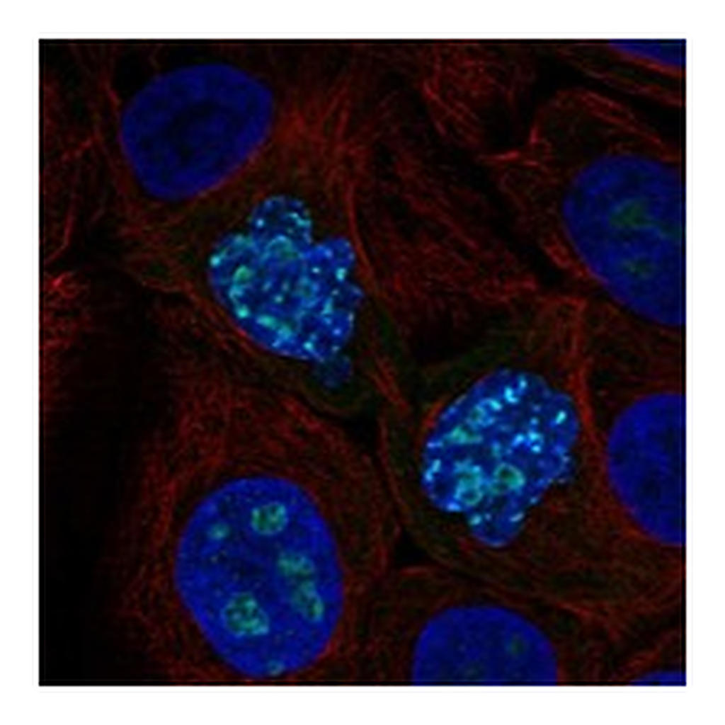 Atlas Antibodies Anti-ZNF202 Antibody