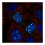 Atlas Antibodies Anti-ZNF202 Antibody