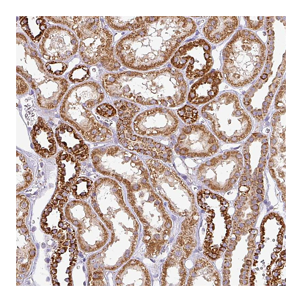 Atlas Antibodies Anti-ZNF211 Antibody