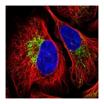 Atlas Antibodies Anti-ZNF211 Antibody