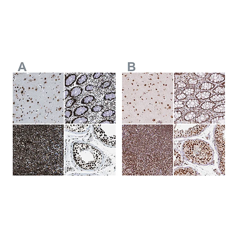 Atlas Antibodies Anti-ZNF207 Antibody