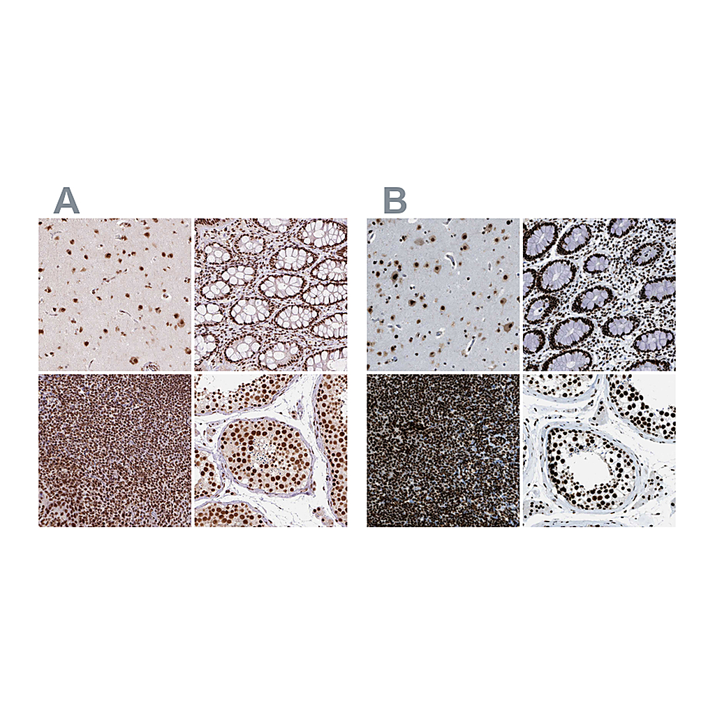 Atlas Antibodies Anti-ZNF207 Antibody