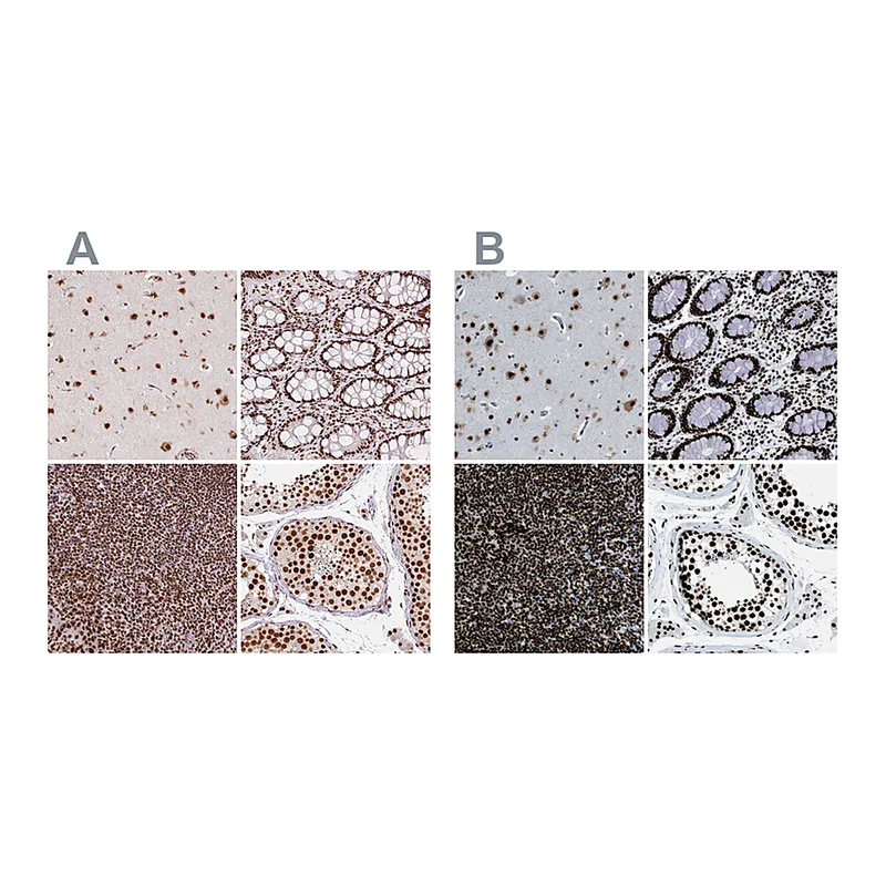 Atlas Antibodies Anti-ZNF207 Antibody