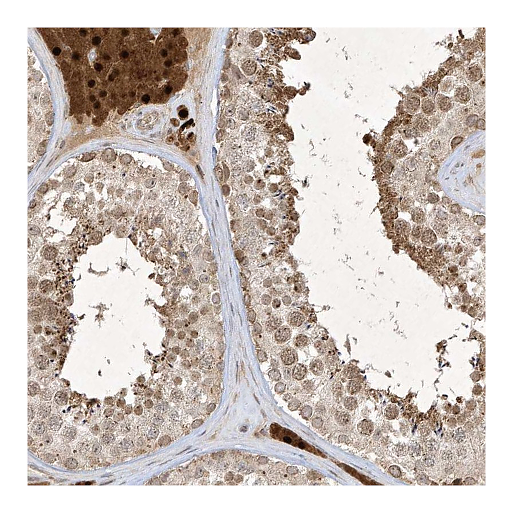 Atlas Antibodies Anti-ZNF213 Antibody