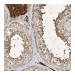 Atlas Antibodies Anti-ZNF213 Antibody