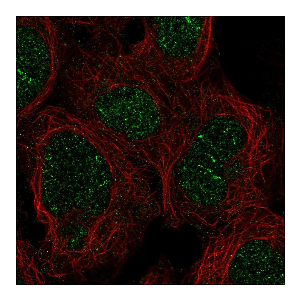 Atlas Antibodies Anti-ZNF212 Antibody