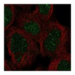 Atlas Antibodies Anti-ZNF212 Antibody