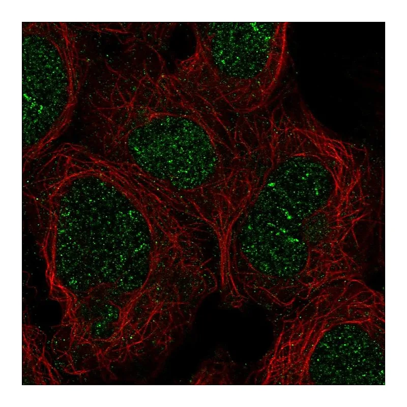 Atlas Antibodies Anti-ZNF212 Antibody