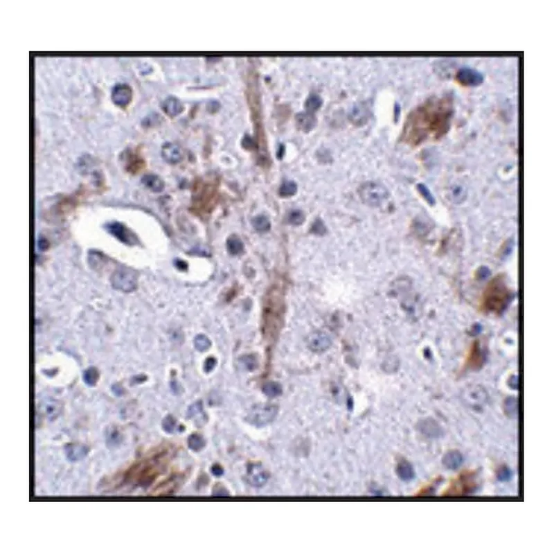 Merck Anti-TTBK1 antibody produced in rabbit