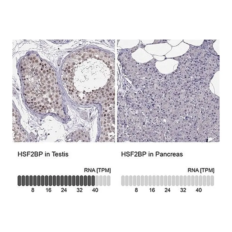 Merck Anti-HSF2BP antibody produced in rabbit
