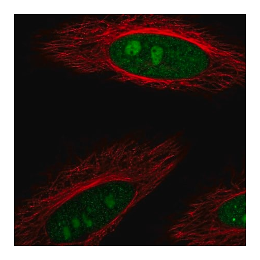 Merck Anti-DDX23 antibody produced in rabbit