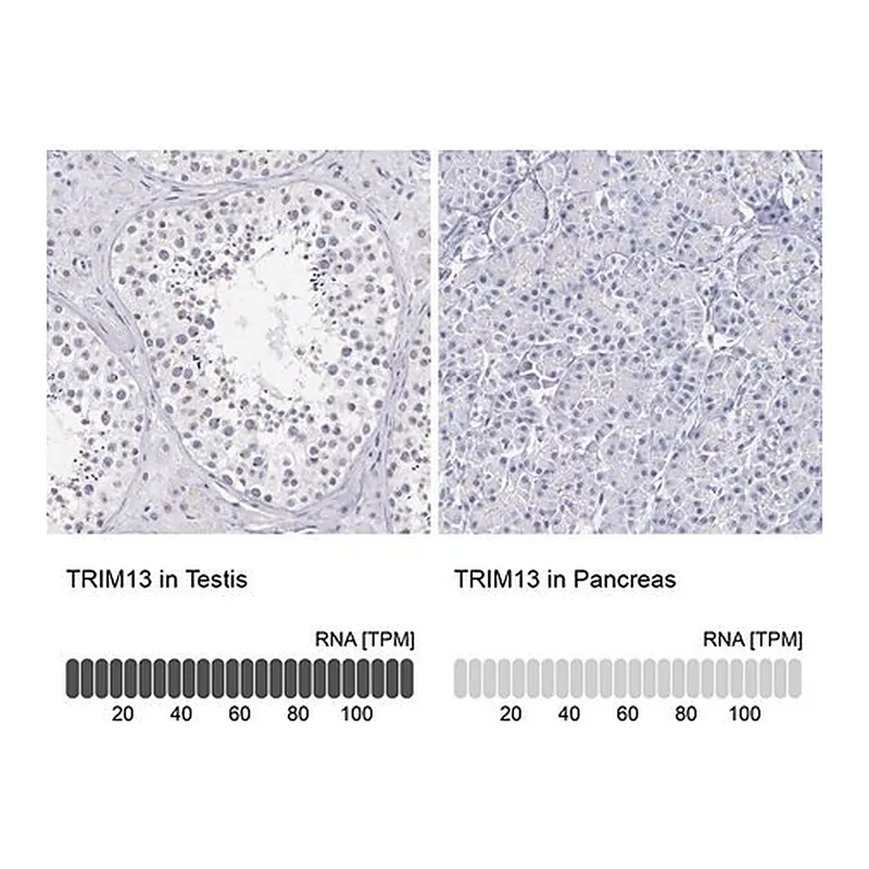 Merck Anti-TRIM13 antibody produced in rabbit