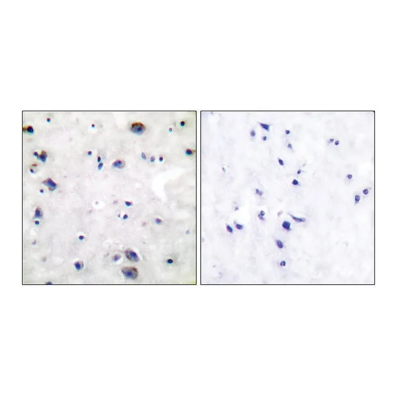 Merck Anti-Opioid Receptor antibody produced in rabbit