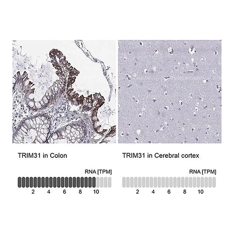 Merck Anti-TRIM31 antibody produced in rabbit