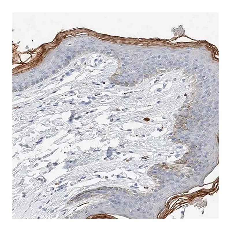 Merck Anti-ALOX12B antibody produced in rabbit