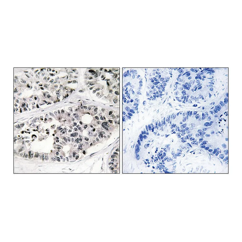 Merck Anti-Collagen VII alpha1 antibody produced in rabbit