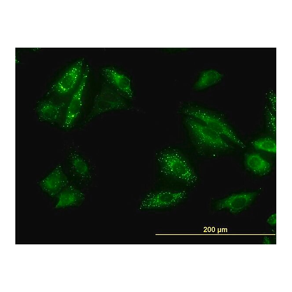 Merck Monoclonal Anti-SQSTM1 antibody produced in mouse