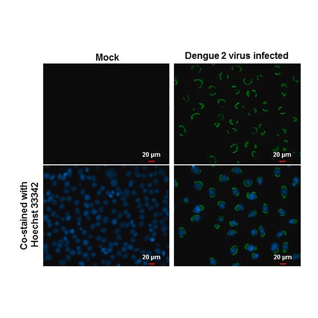 Merck ANTI-ENVELOPE PROTEIN