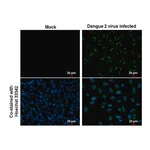 Merck ANTI-ENVELOPE PROTEIN