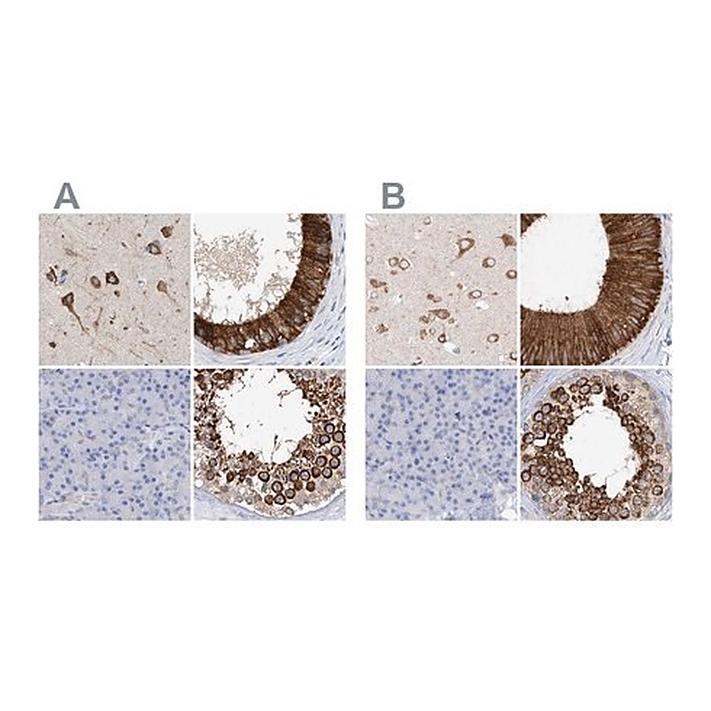 Merck Anti-RCN2 antibody produced in rabbit