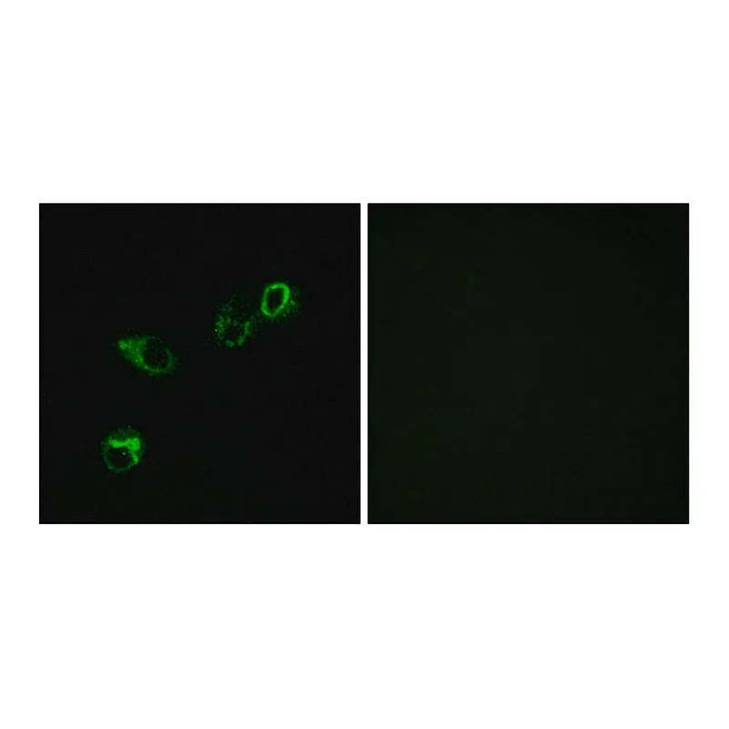 Merck Anti-CCRL1 antibody produced in rabbit