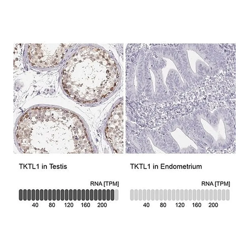 Merck Anti-TKTL1 antibody produced in rabbit