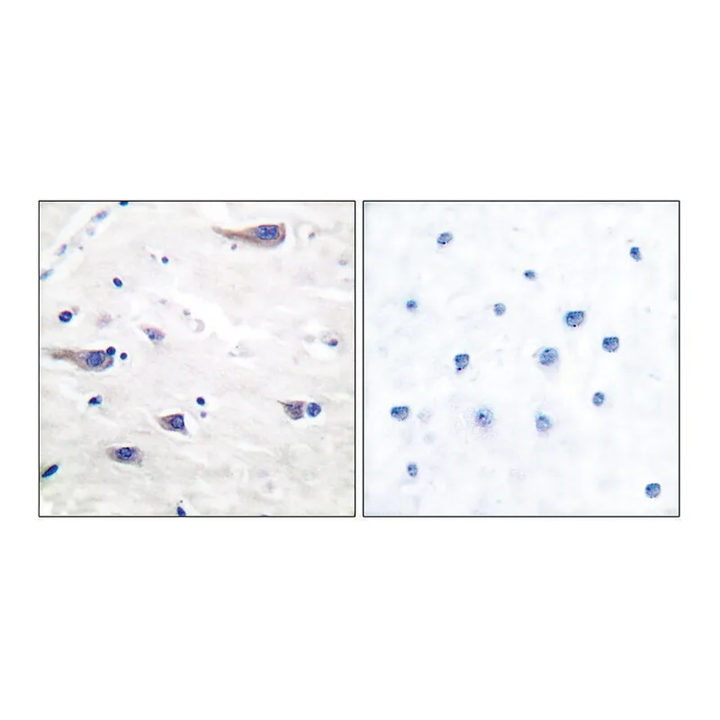 Merck Anti-PDGF Receptor beta antibody produced in rabbit