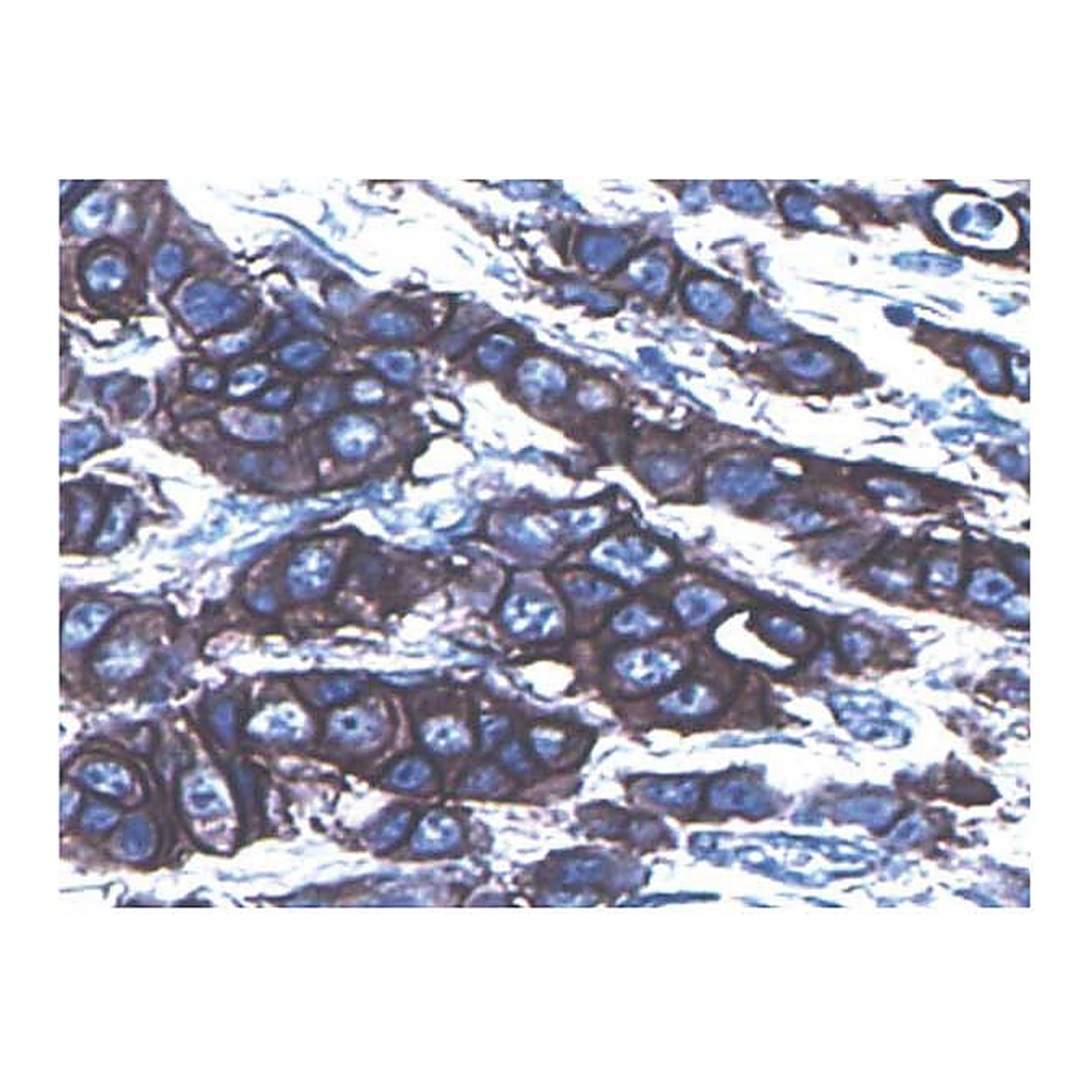 BD Purified Mouse Anti-Human c-ErbB-2
