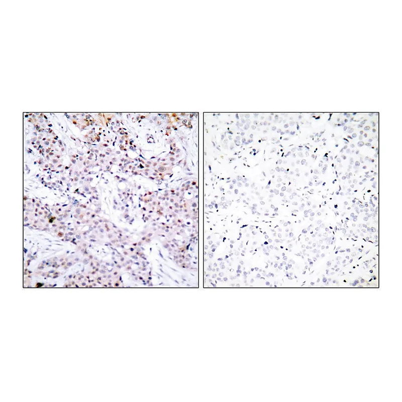 Merck Anti-Estrogen Receptor-alpha antibody produced in rabbit