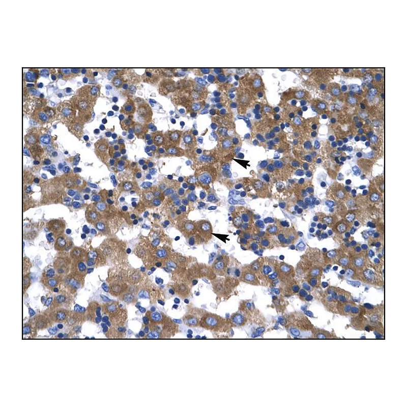 Merck Anti-VDAC1
