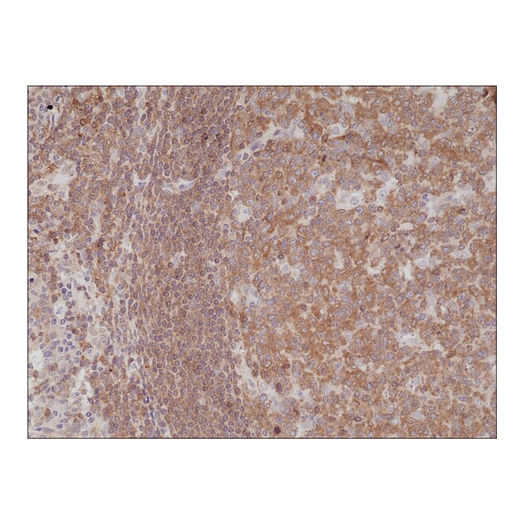Merck Anti-NF-kappa-B p105/p50 antibody, Rabbit Monoclonal