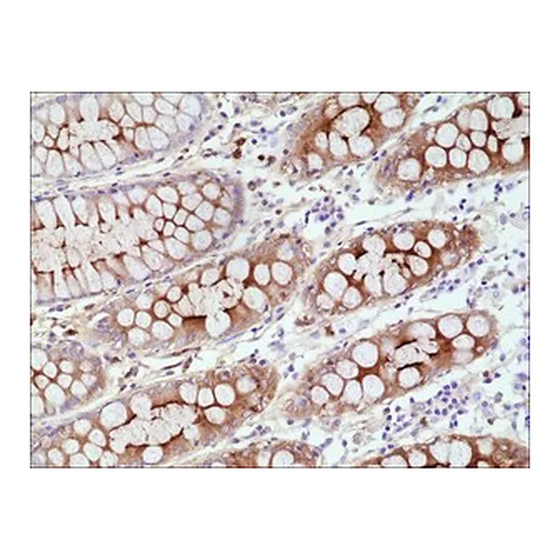 Merck ANTI-CEA (CD66E) ANTIBODY, RABBIT MONOCL