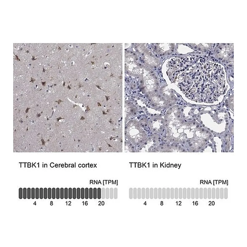 Merck Anti-TTBK1 antibody produced in rabbit