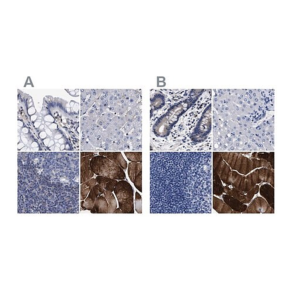 Merck Anti-KLHL41 antibody produced in rabbit