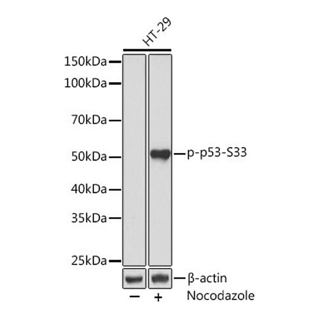 Merck Anti-Phospho-p53-S33 antibody produced in rabbit