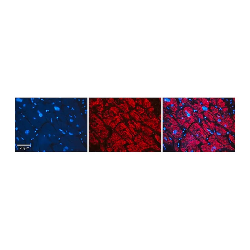 Merck Anti-AKR1B1 antibody produced in rabbit