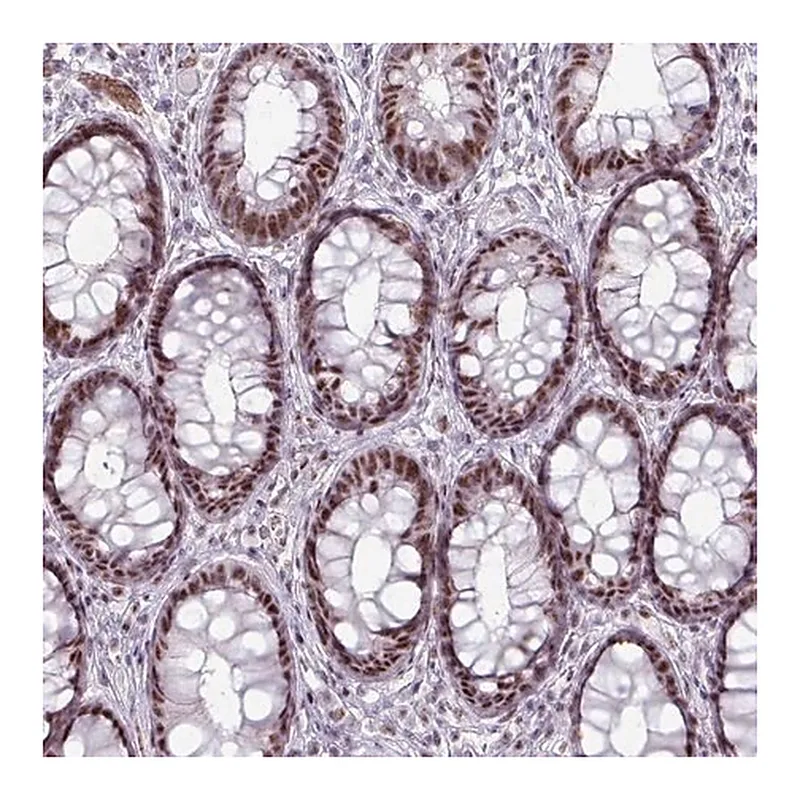 Merck Anti-NCOR1 antibody produced in rabbit