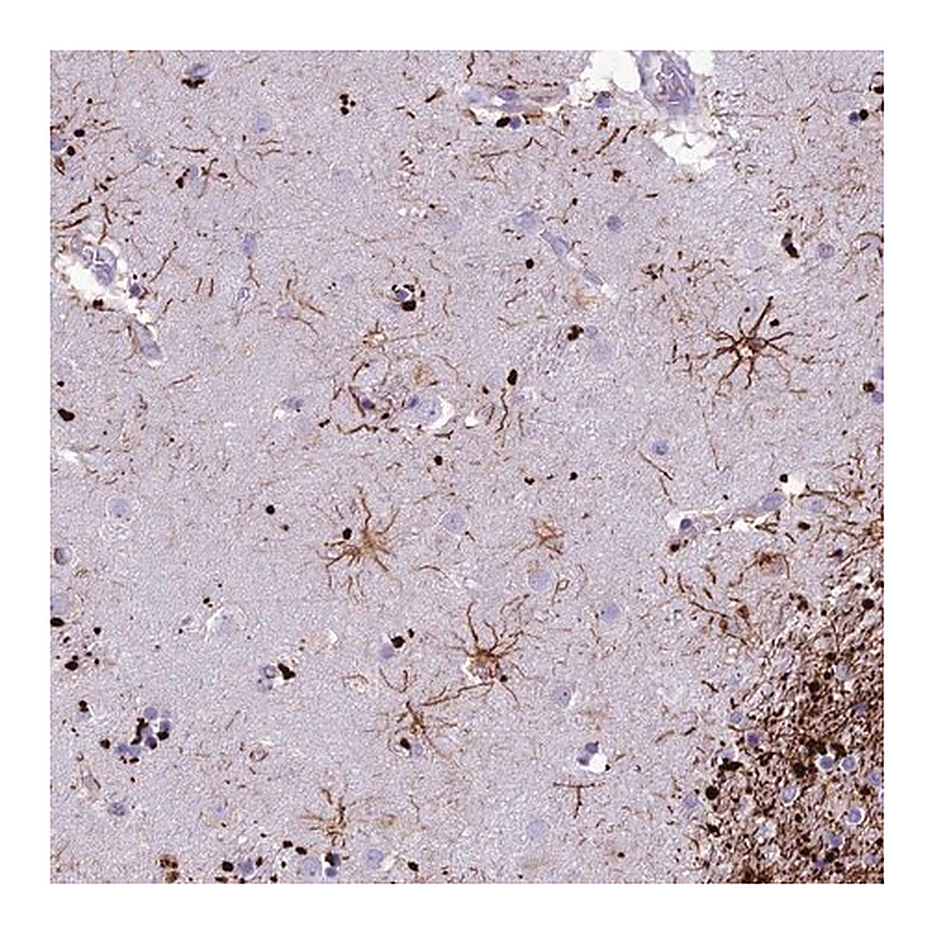 Merck Anti-IFT172 antibody produced in rabbit