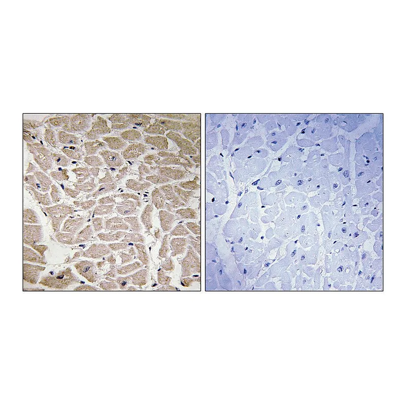 Merck Anti-Collagen XVI alpha1 antibody produced in rabbit