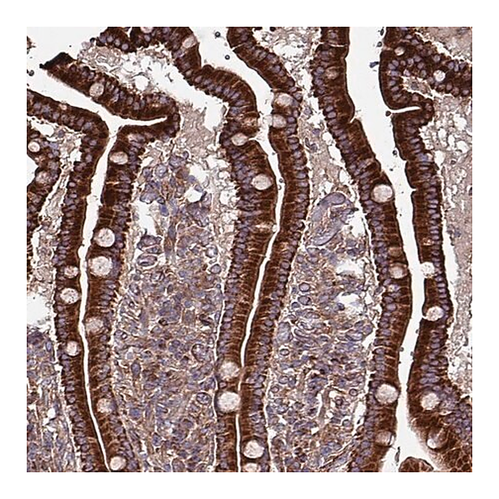 Merck Anti-ANO10 antibody produced in rabbit