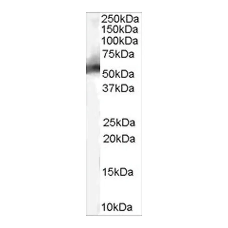 Merck Anti-MDM2 (Isoform) antibody produced in goat