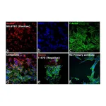 Thermo Fisher Scientific Goat anti-Mouse IgG (H+L) Cross-Adsorbed Secondary Antibody, Rhodamine Red-X