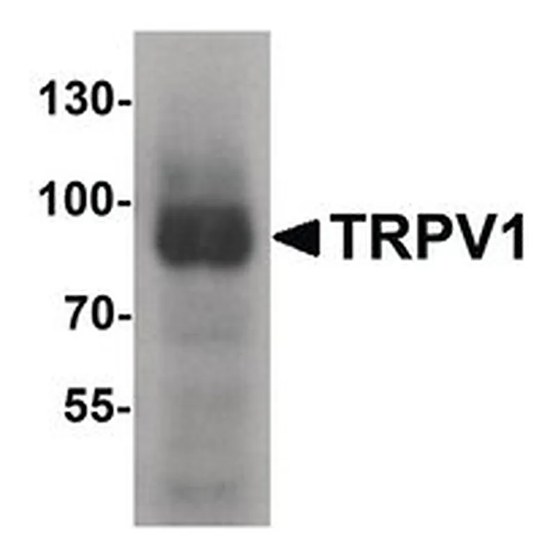 Merck ANTI-TRPV1